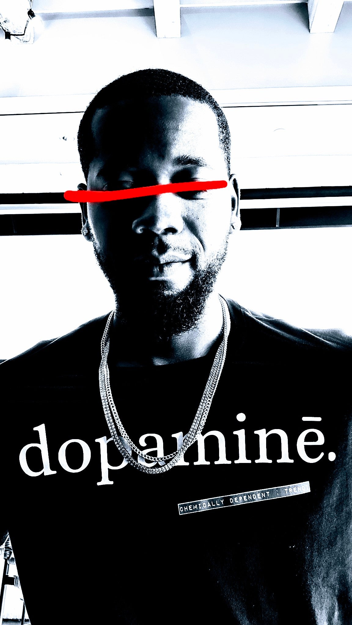 [dopamine.]